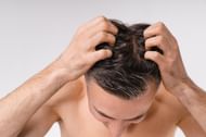 Scalp scabs (Image via Getty Images)